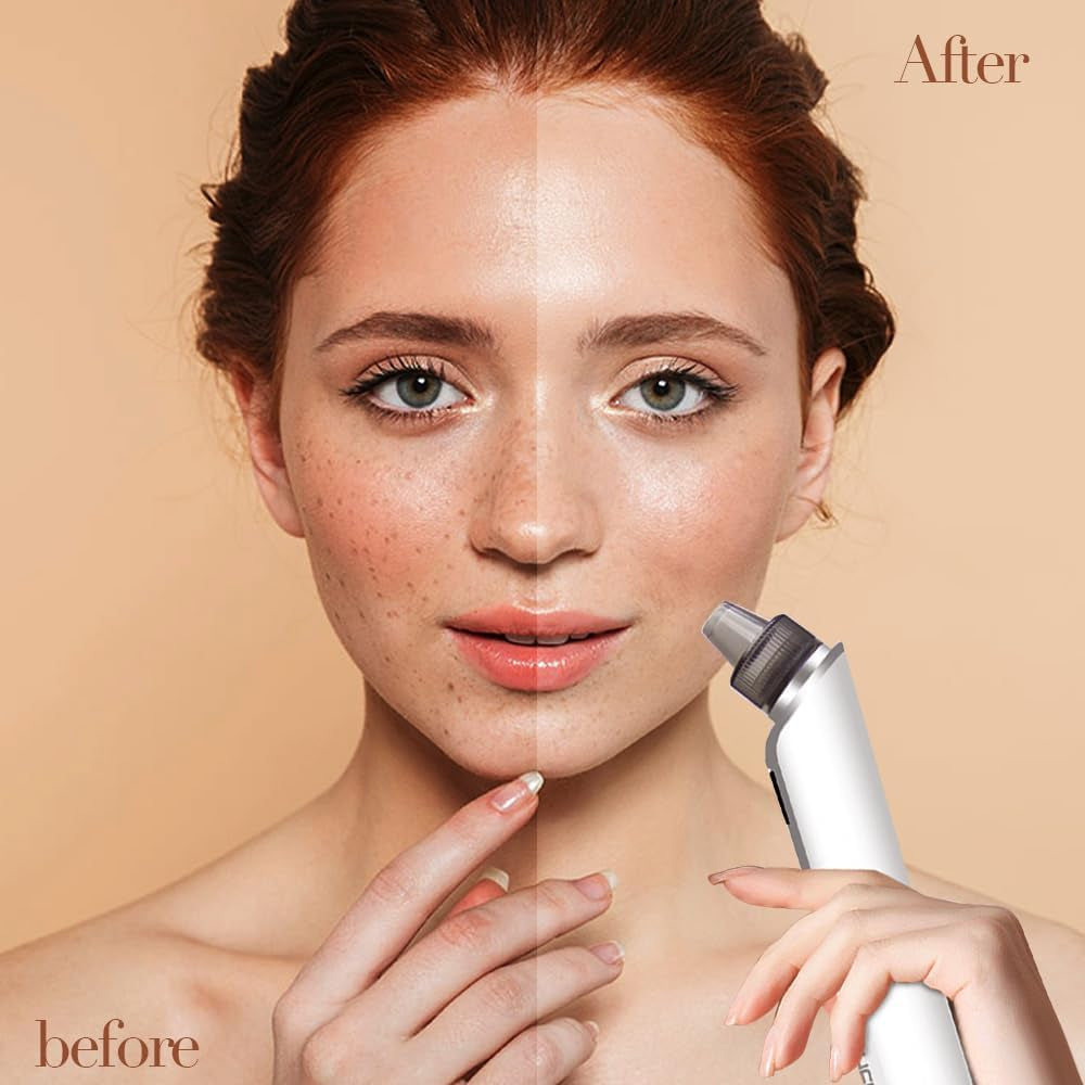 Electric Blackhead Remover with LED Display