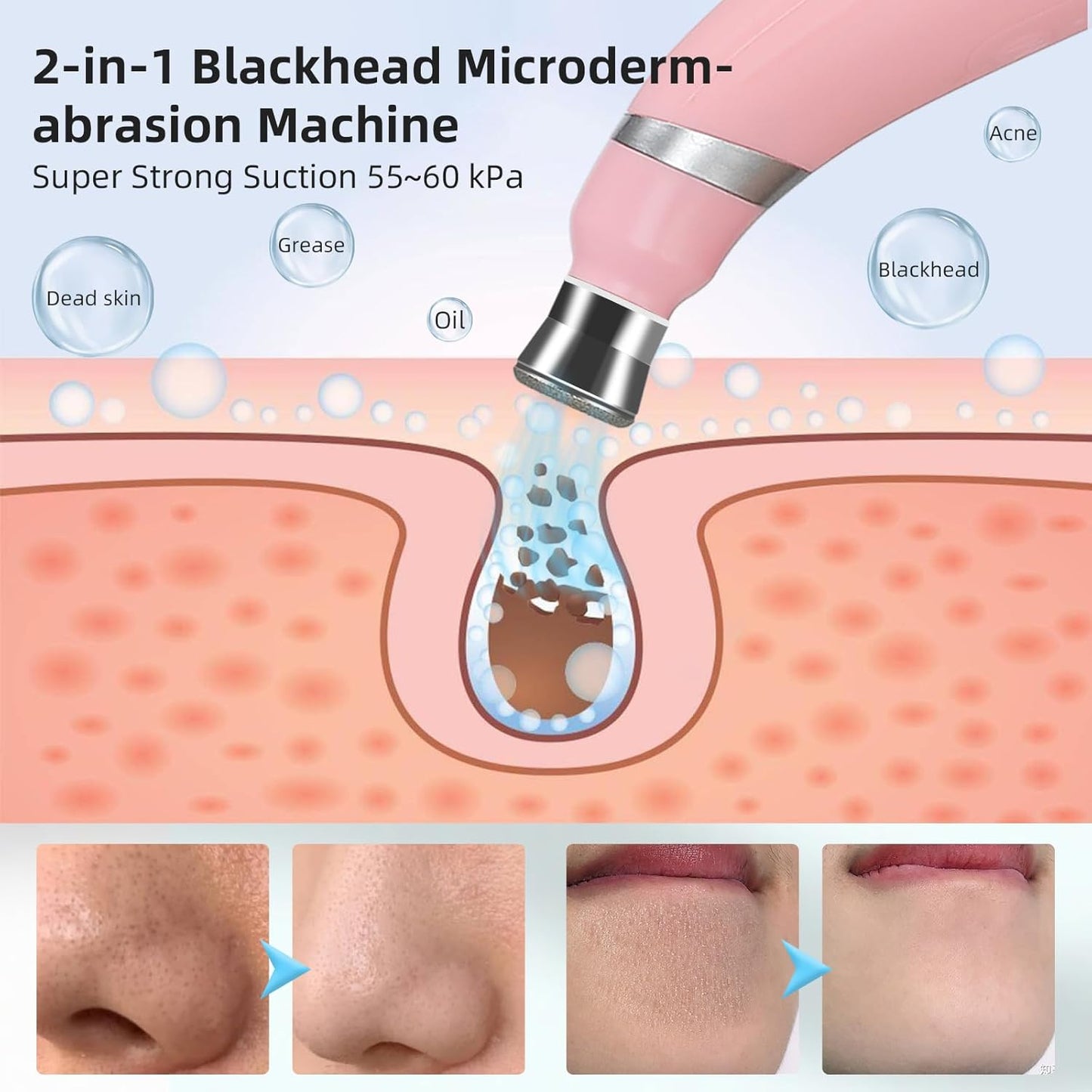 Deep Cleansing Pore Vacuum